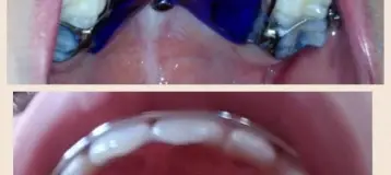 Little Smile Big Smile: Eli Gherman, DDS