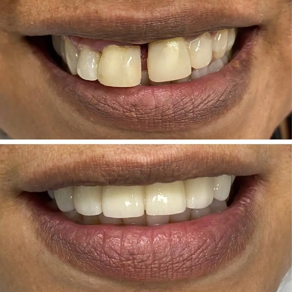 The Dental Suite - Mariya Dayanayeva, DDS