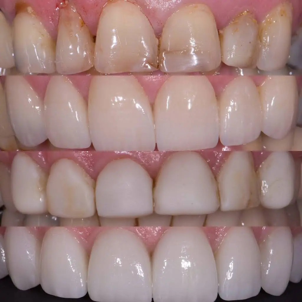 Bayonne Smile Center