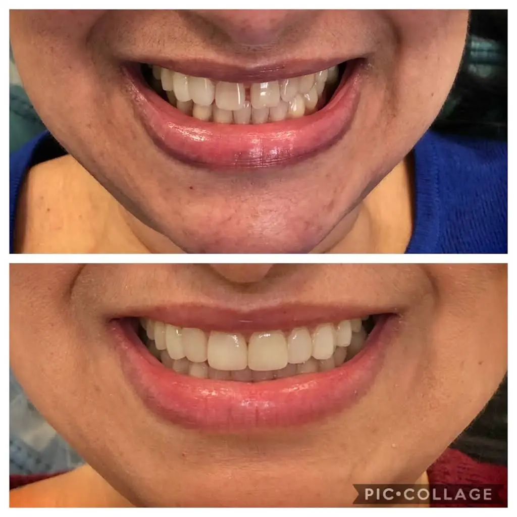 Allure Dental Aesthetics
