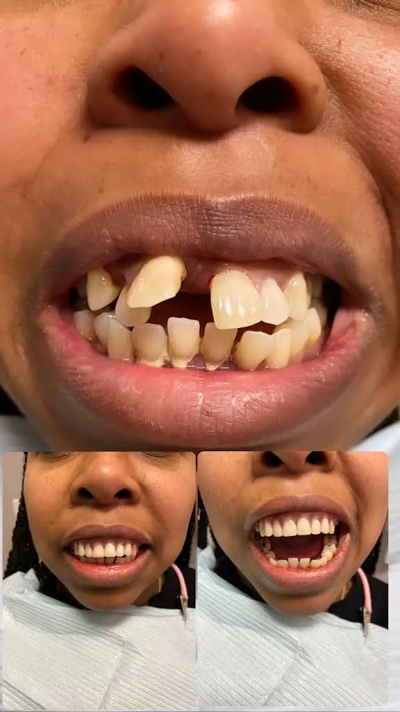 Teaneck Dental Associates