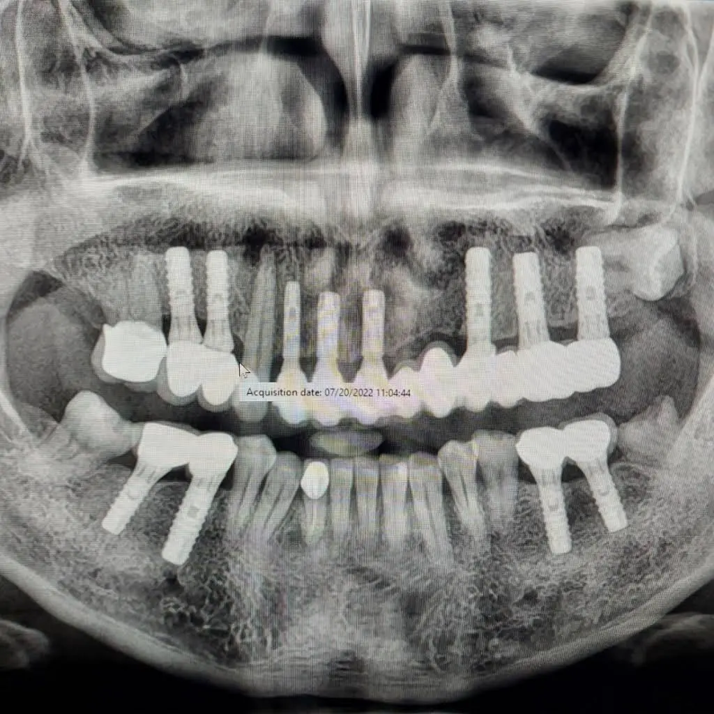 Align Dental Care