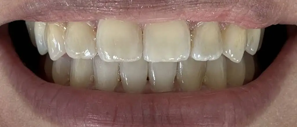 Chester Dental Associates
