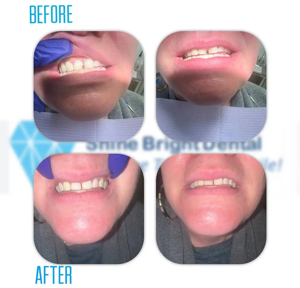 Shine Bright Dental and MedSpa