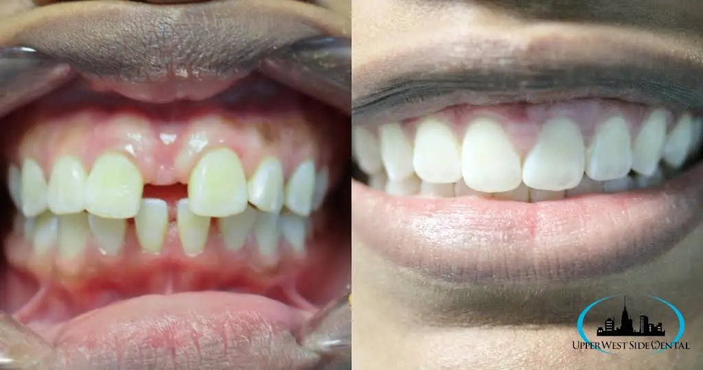 Upper West Side Dental