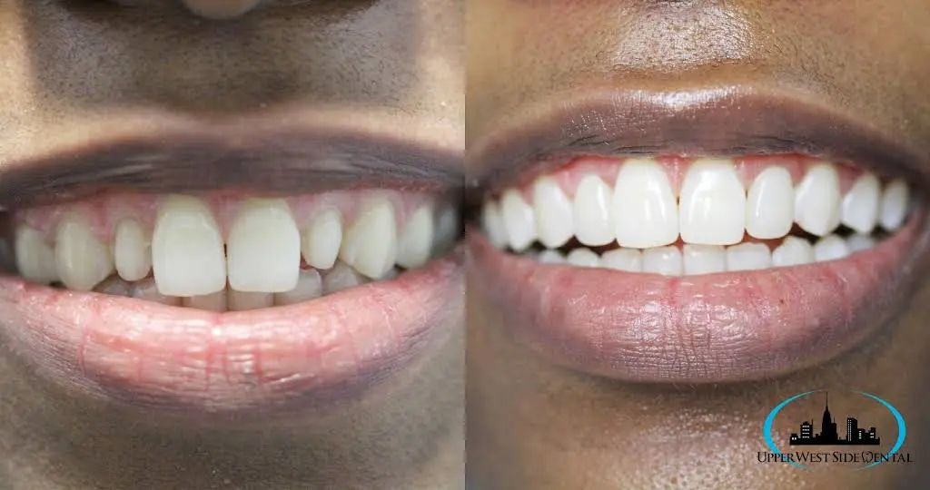 Upper West Side Dental