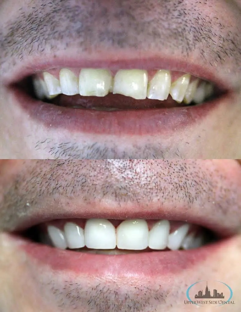Upper West Side Dental