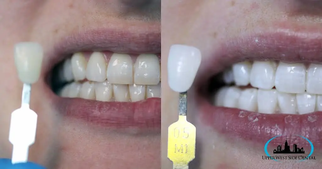 Upper West Side Dental