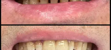 Dental Korner