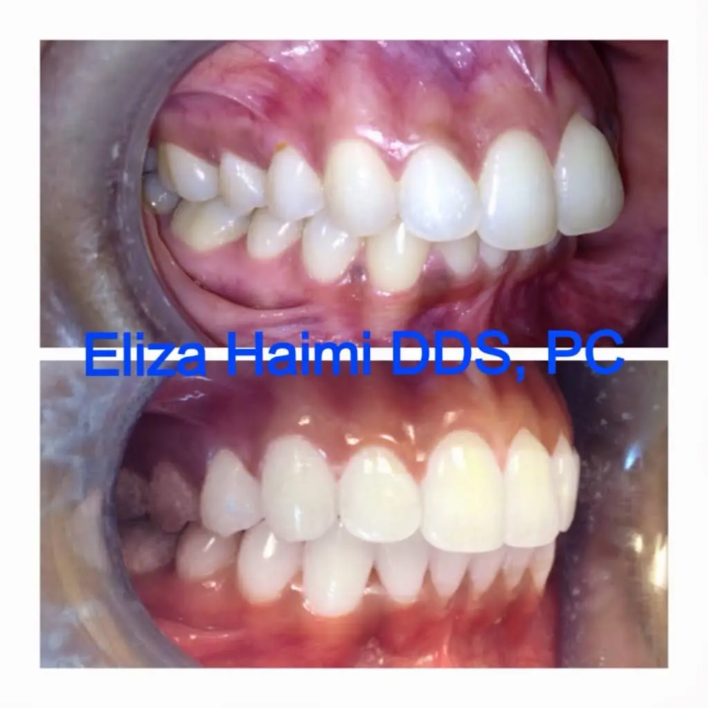 Eliza Haimi DDS
