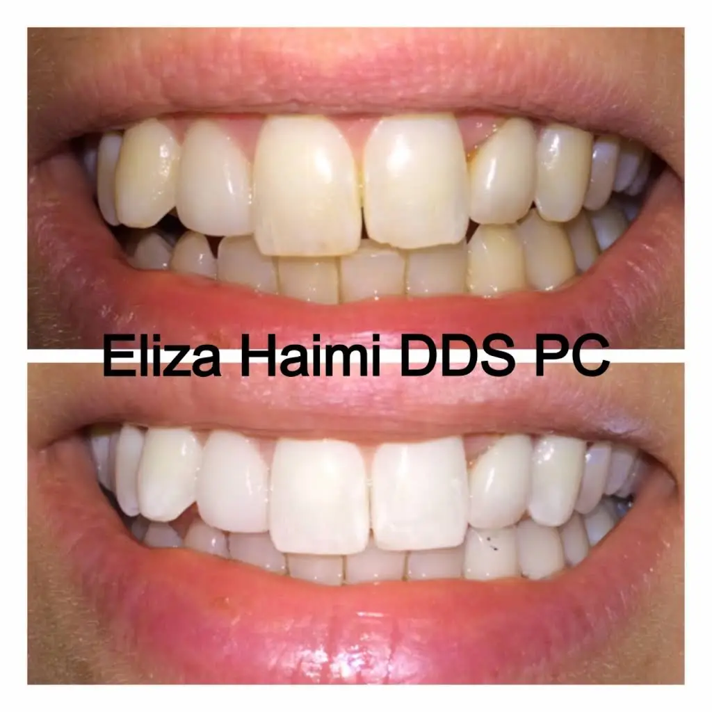 Eliza Haimi DDS
