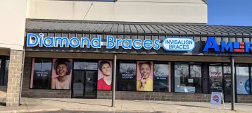 Diamond Braces
