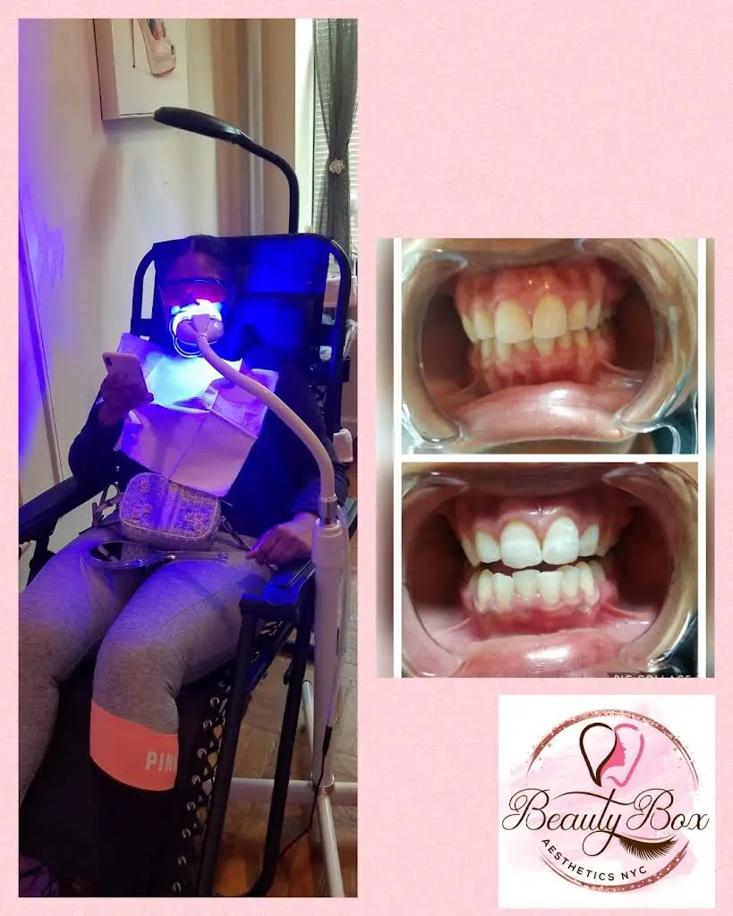 Beauty Central - Teeth Whitening Bayonne
