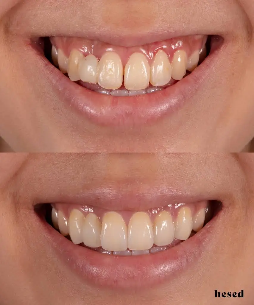 Hesed Dental
