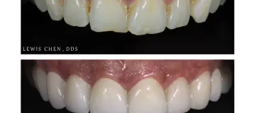 Beam Dental