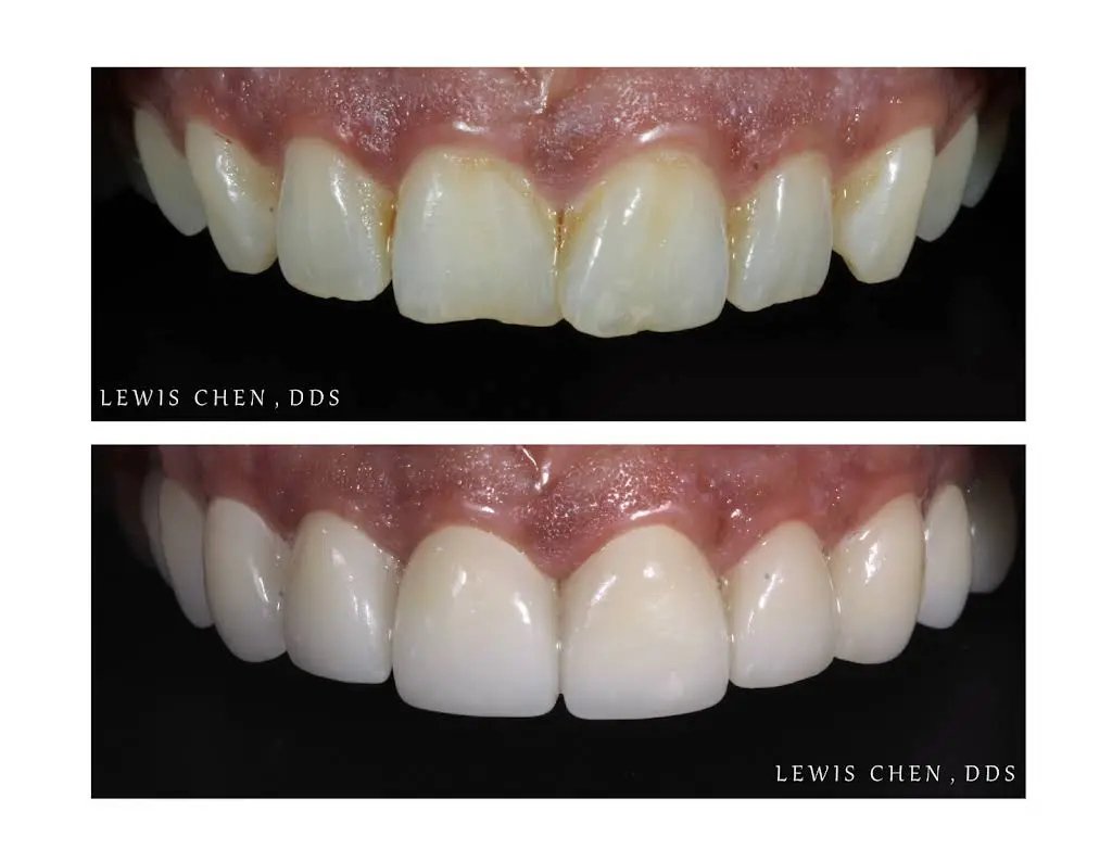 Beam Dental - Professional dental clinic exterior with modern facilities