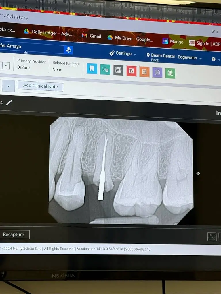 Beam Dental