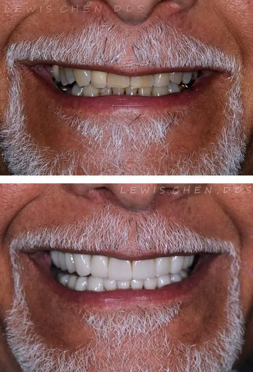 Beam Dental