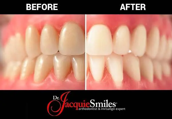 Dr. Jacquie Smiles