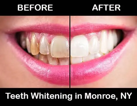 Dr. Jacquie Smiles