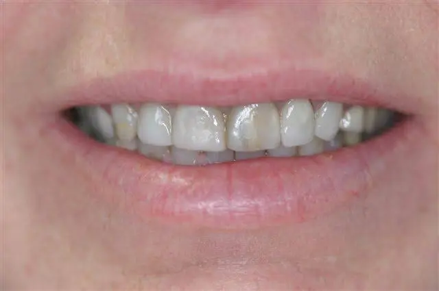 Donato Dental