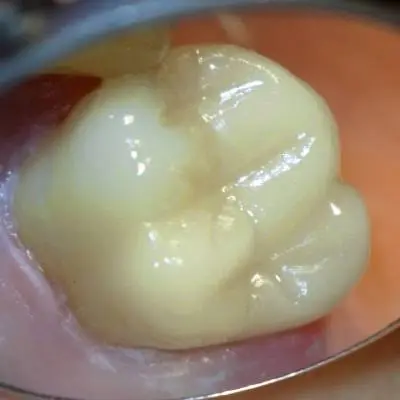Donato Dental