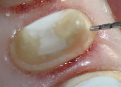 Donato Dental