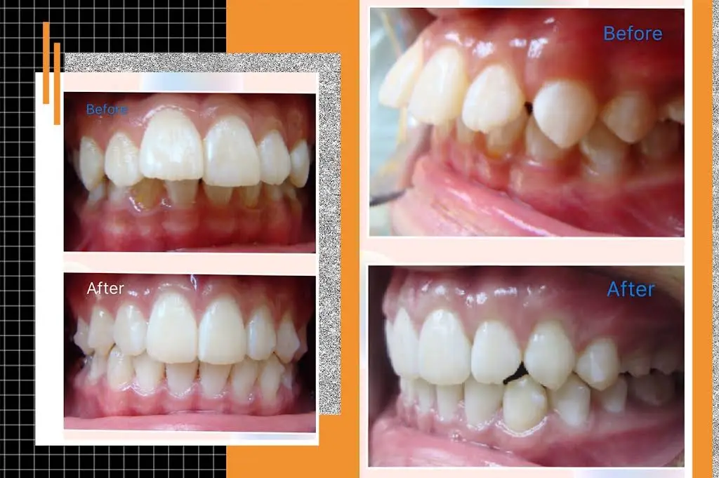 Bond Orthodontics & Dental Care PLLC