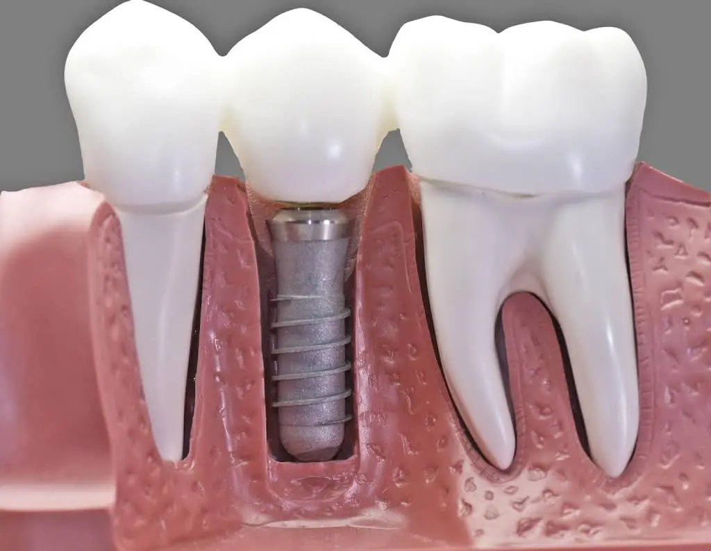 North Shore Long Island Periodontics and Dental Implants Center