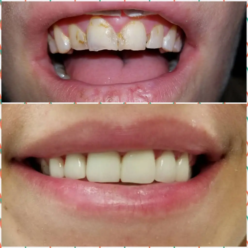 Bral Dentistry
