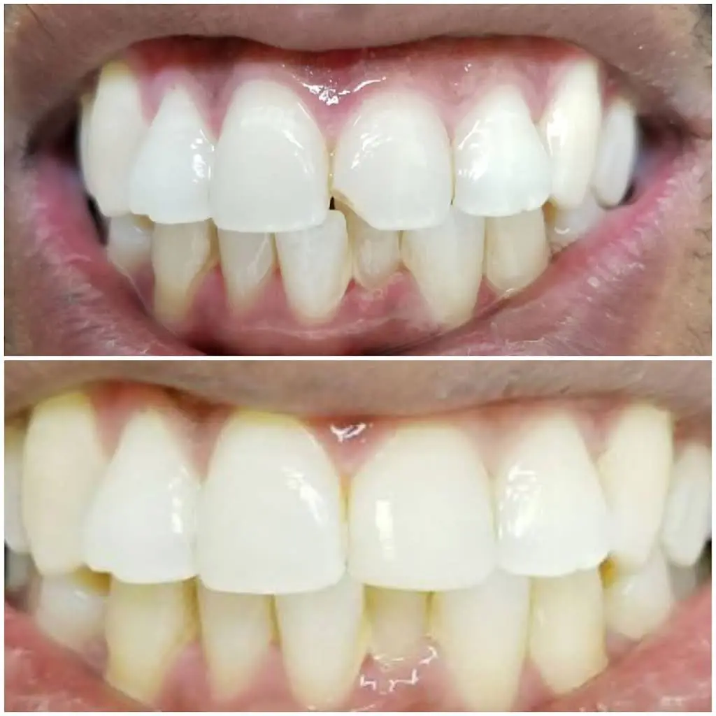 Bral Dentistry