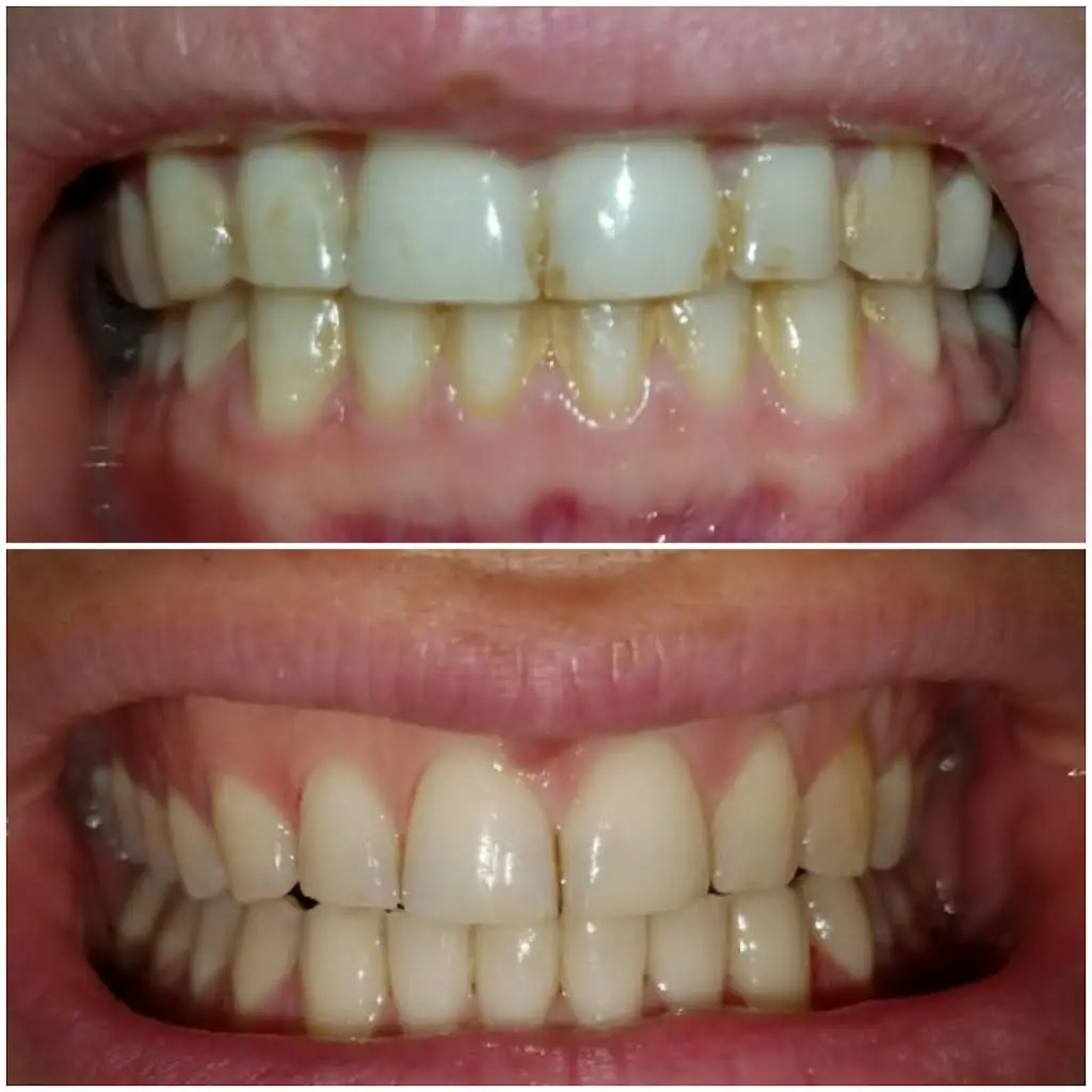 Bral Dentistry