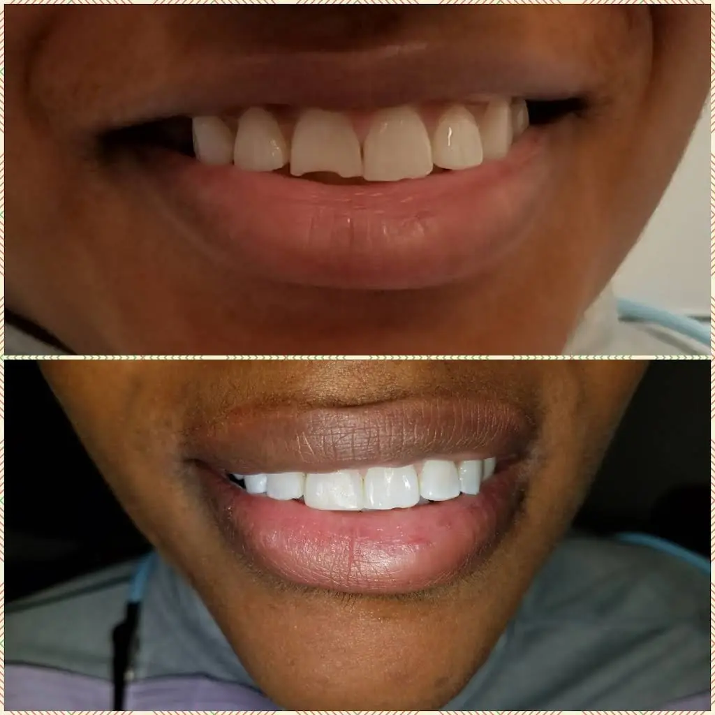 Bral Dentistry
