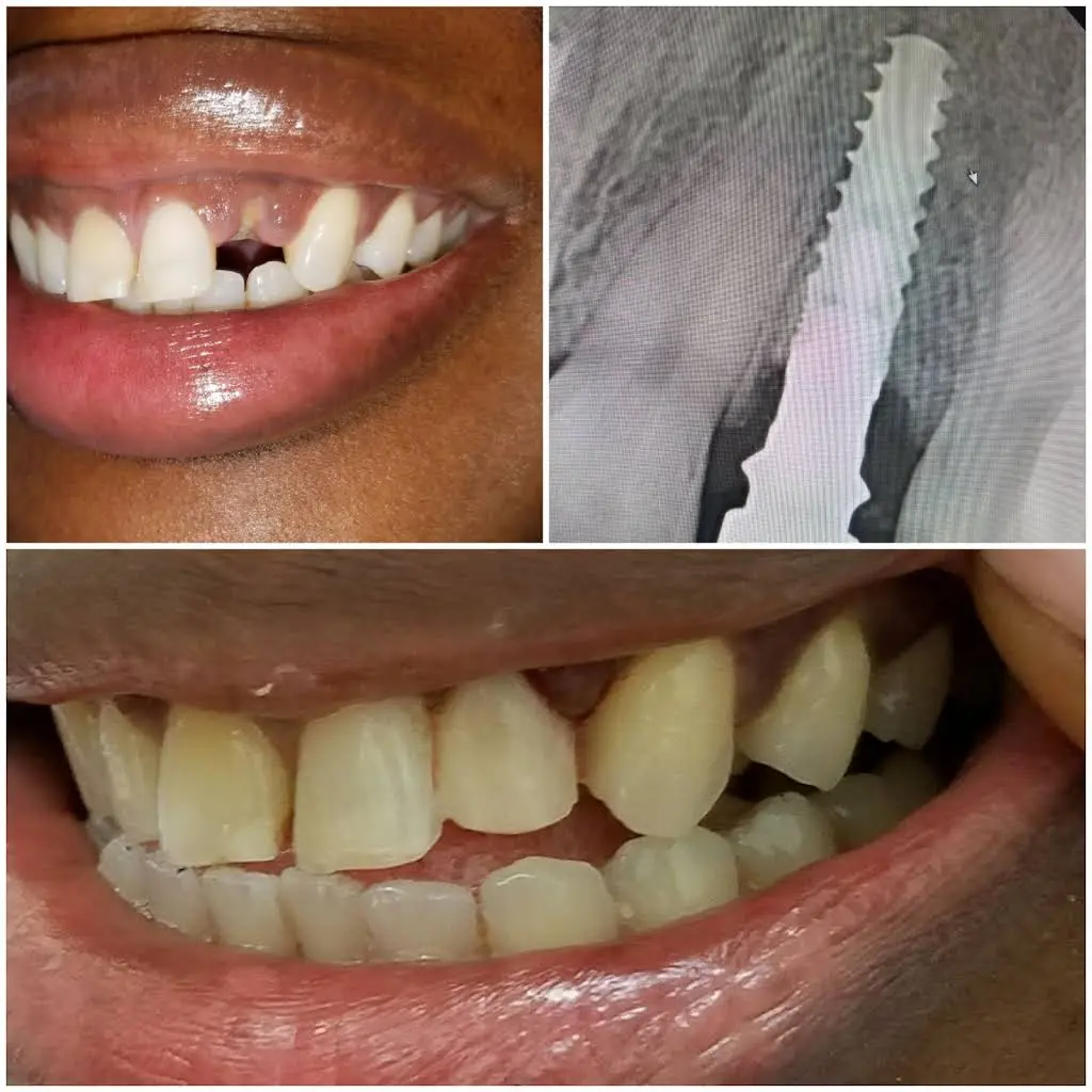 Bral Dentistry