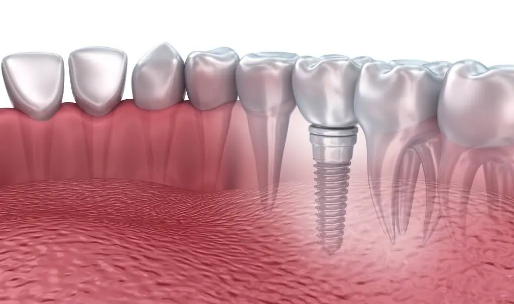 Hudson Valley Periodontics & Implantology