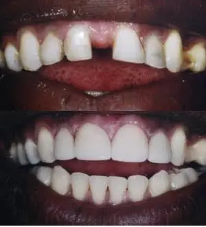 Bruce G Freund, DDS - A Dental365 Company