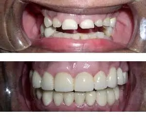 Bruce G Freund, DDS - A Dental365 Company