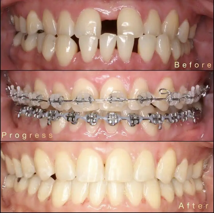 Ramaswamy Orthodontics