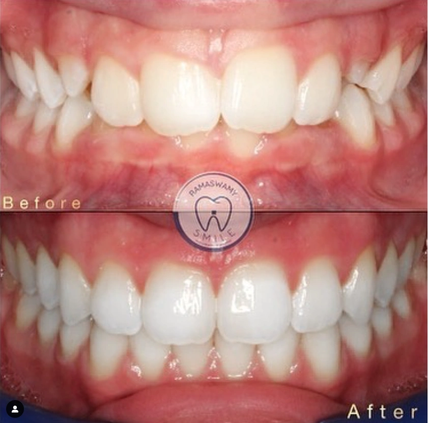 Ramaswamy Orthodontics