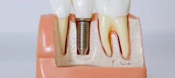 Advanced Family Dentistry