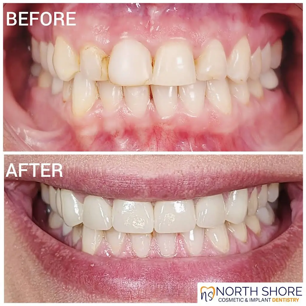 North Shore Cosmetic and Dental Implants