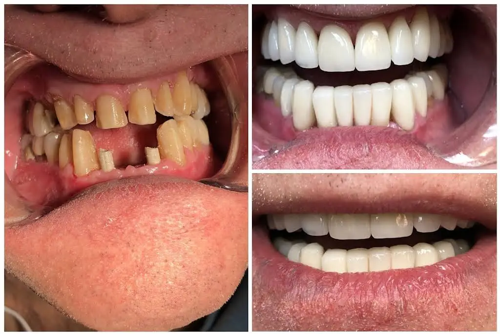 Now Dental