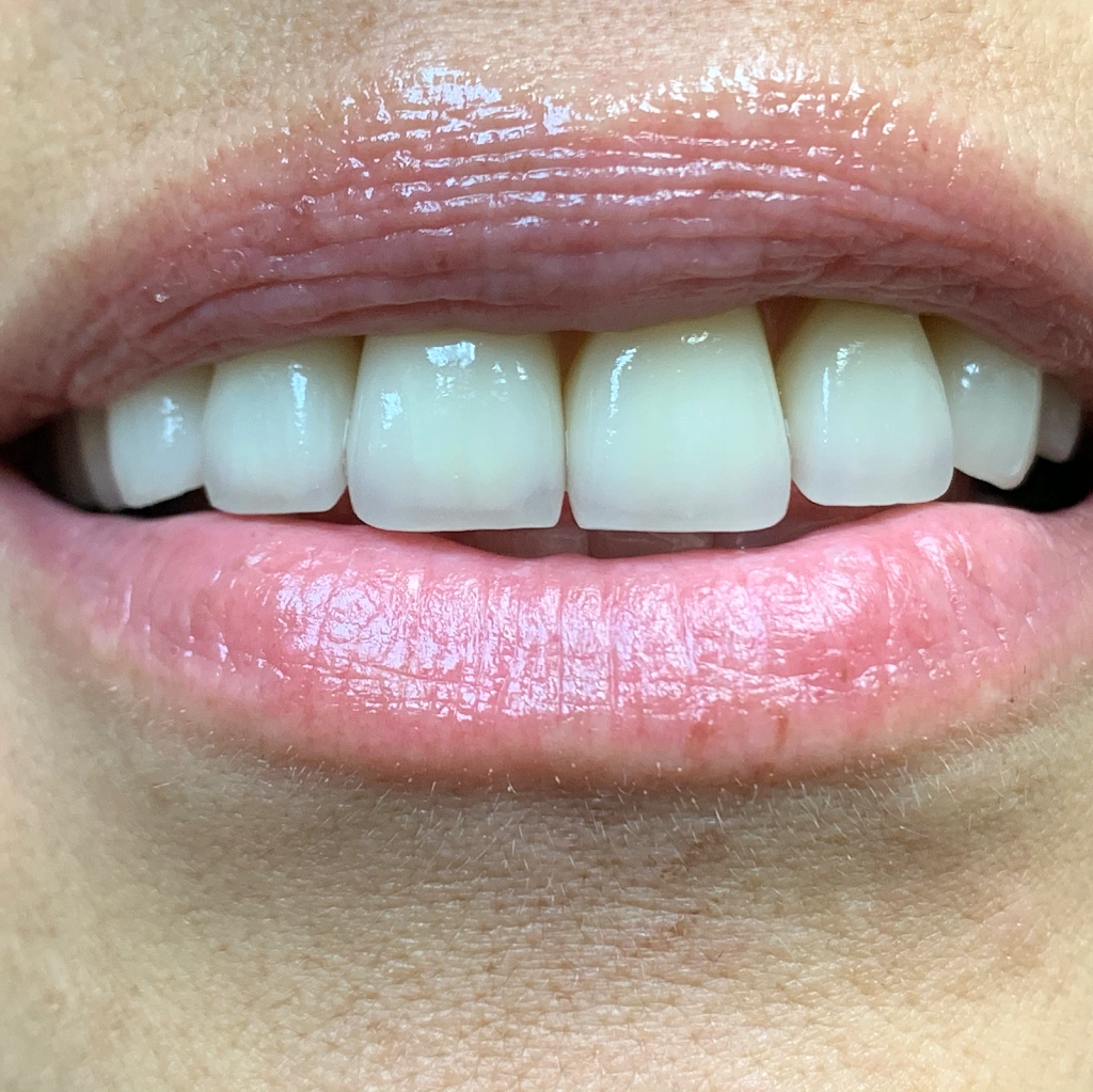 Now Dental