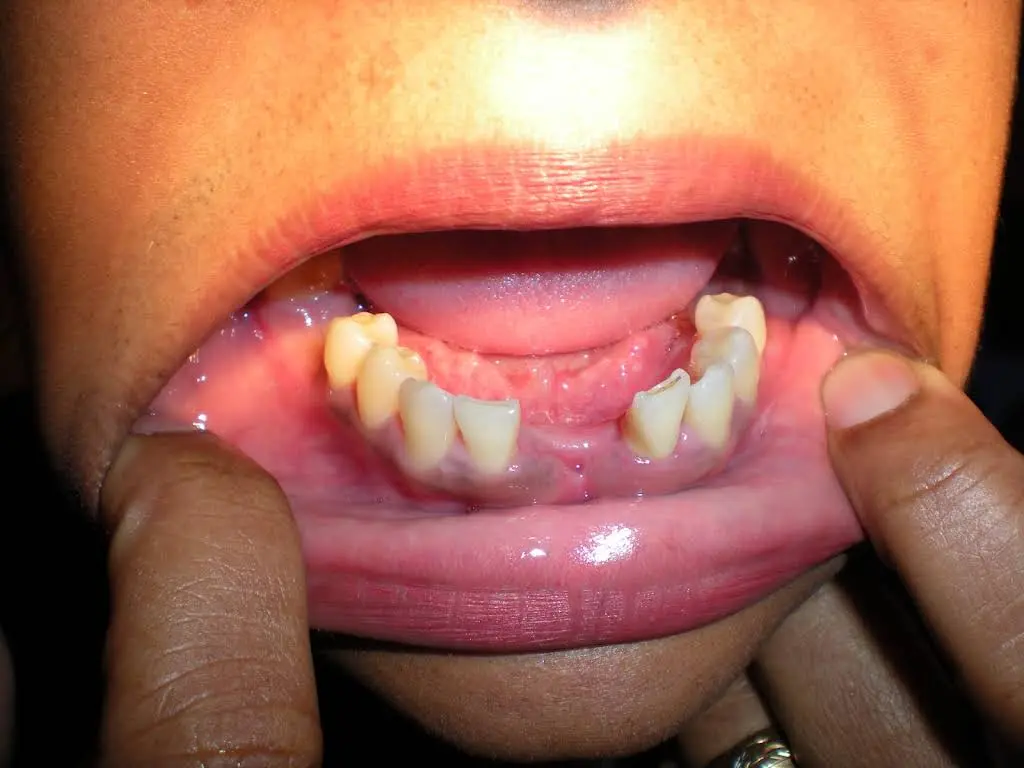Boulevard Dental Associates, PA
