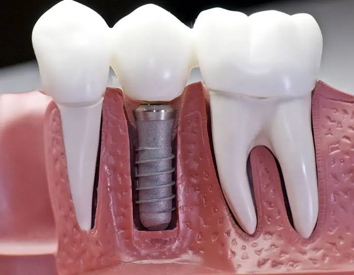 Boulevard Dental Associates, PA