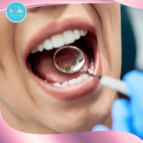 Smile Orthodontists