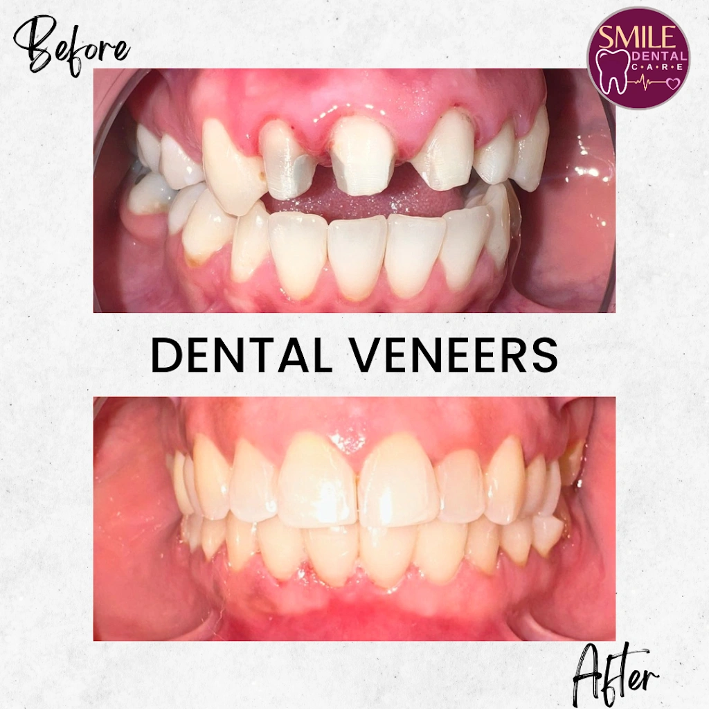 Smile Dental Care