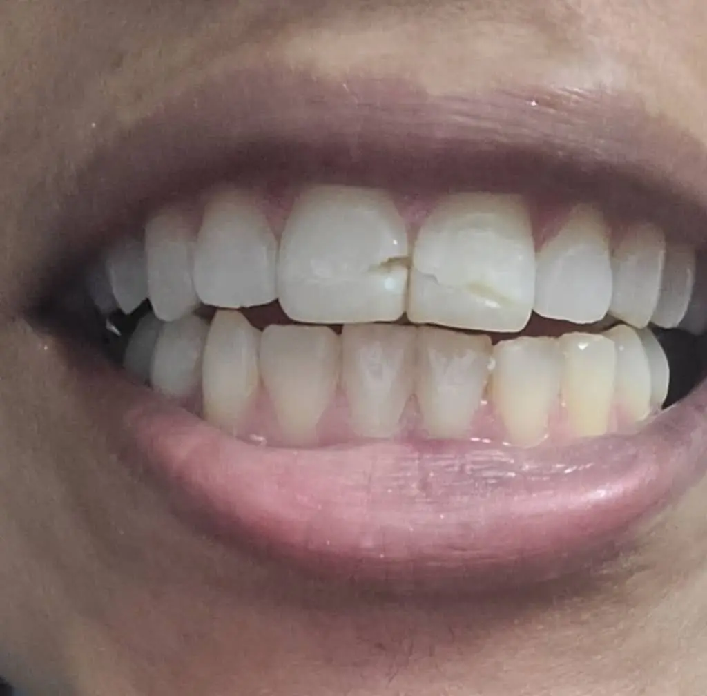 Smile Dental Care