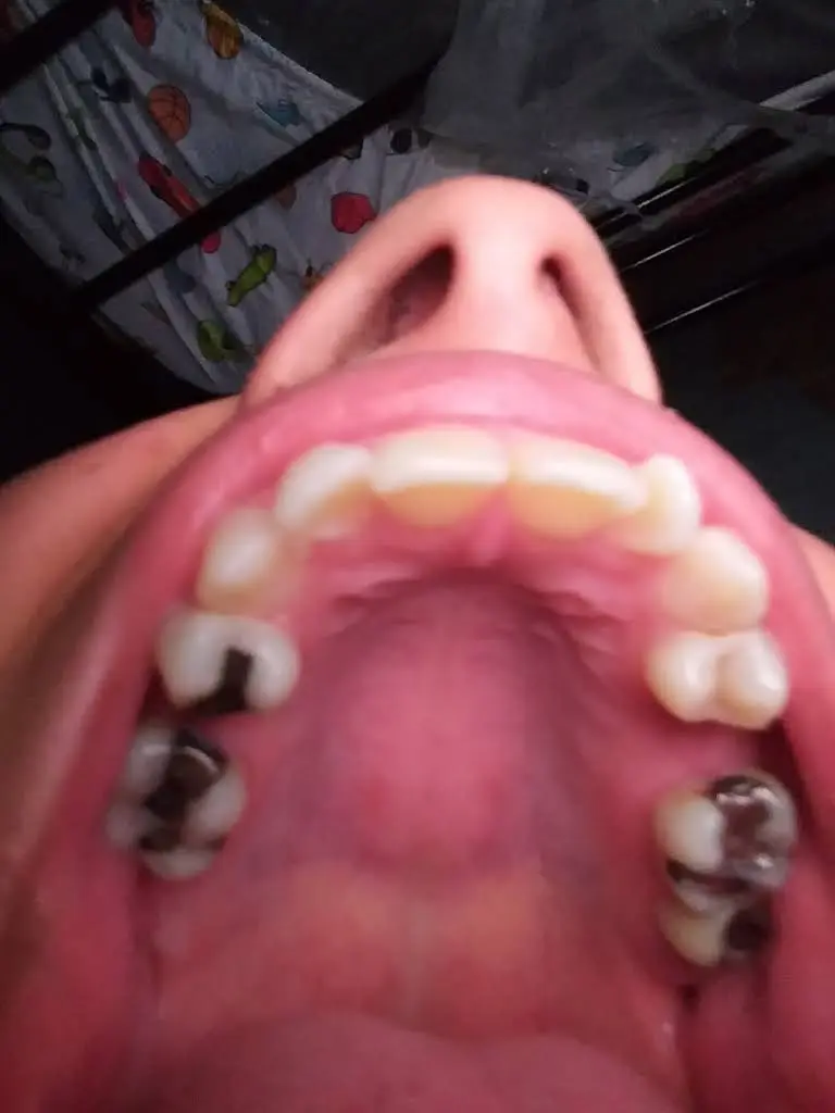 Dental Oral Surgery