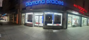 Diamond Braces